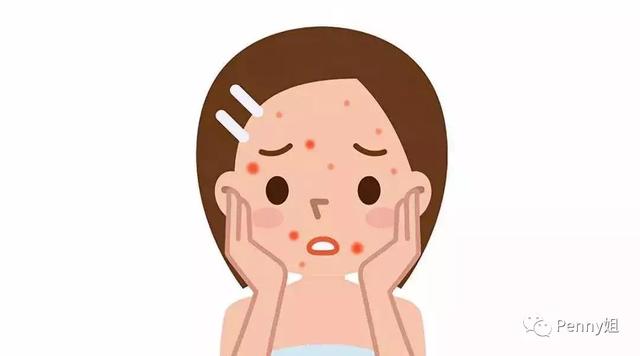 如何消除粉刺痕迹和疤痕? 如何消除粉刺痕迹和疤痕?
