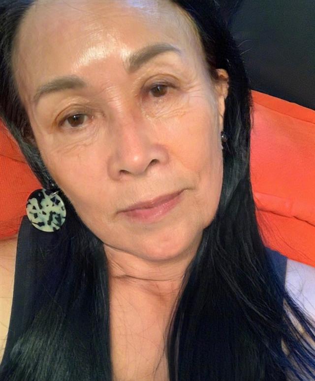 50年后那英变老的模样,双眼皮突出面部松弛,看着让人心疼 50年后那英变老的模样,双眼皮突出面部松弛,看着让人心疼