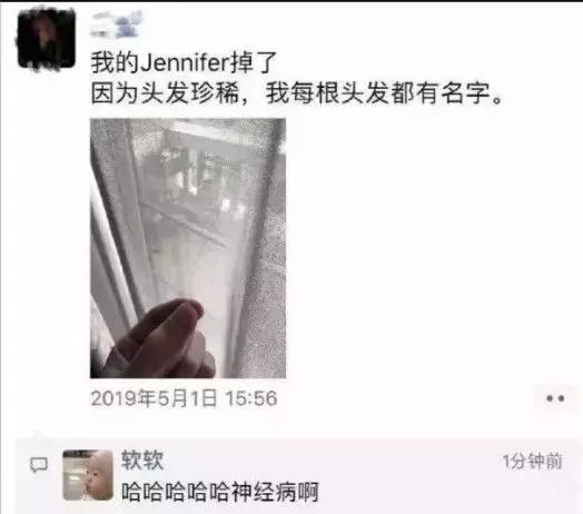 脱发量是多少?医生教你一秒钟的自我测试,这很实用 脱发量是多少?医生教你一秒钟的自我测试,这很实用